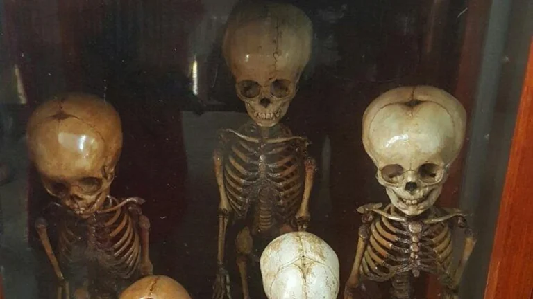 Siriraj Medical Museum dark exhibit