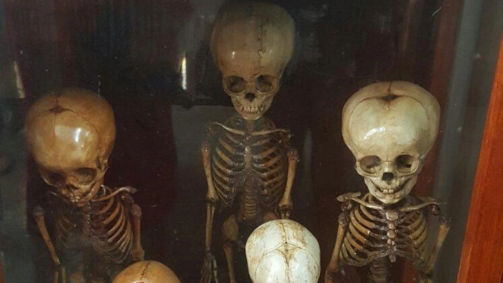 Inside Bangkok’s Siriraj Medical Museum: The ‘Museum of Death’ That Defies Expectation