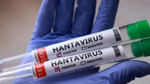 Hantavirus outbreak risk map