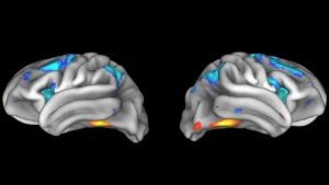 Brain scan replication crisis illustration