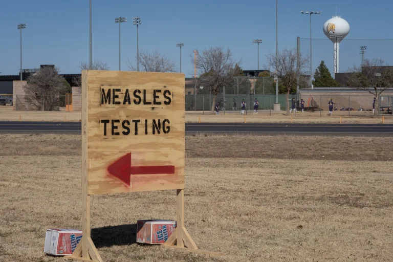 US measles cases biotech response