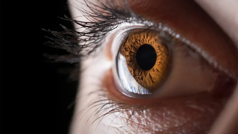 3D printed cornea implant