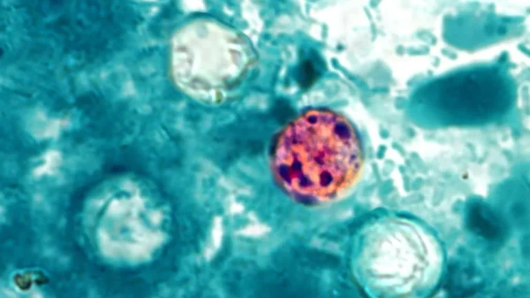 Michigan Cyclospora outbreak deaths