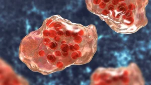 Pennsylvania measles deaths headline