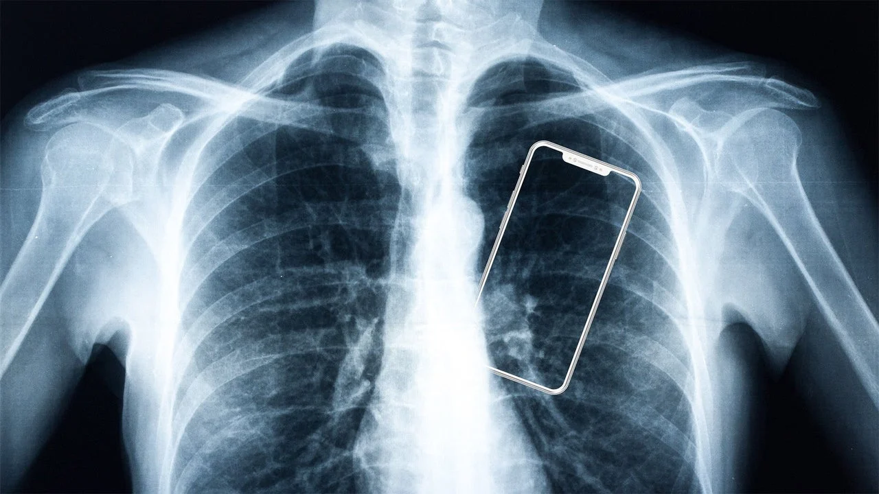 The “Phone Body” Phenomenon: How Smartphones Are Reshaping Your Health