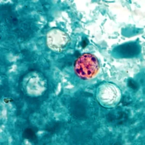 Trump halts Cyclospora research